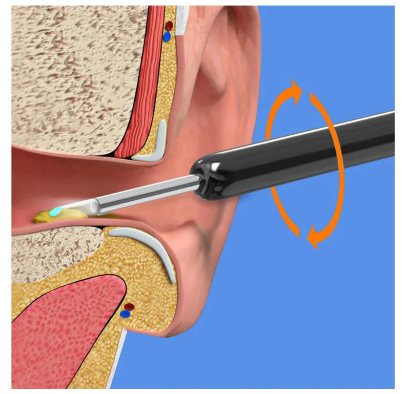 Ear Cleaning Kit | طقم تنظيف الأذن